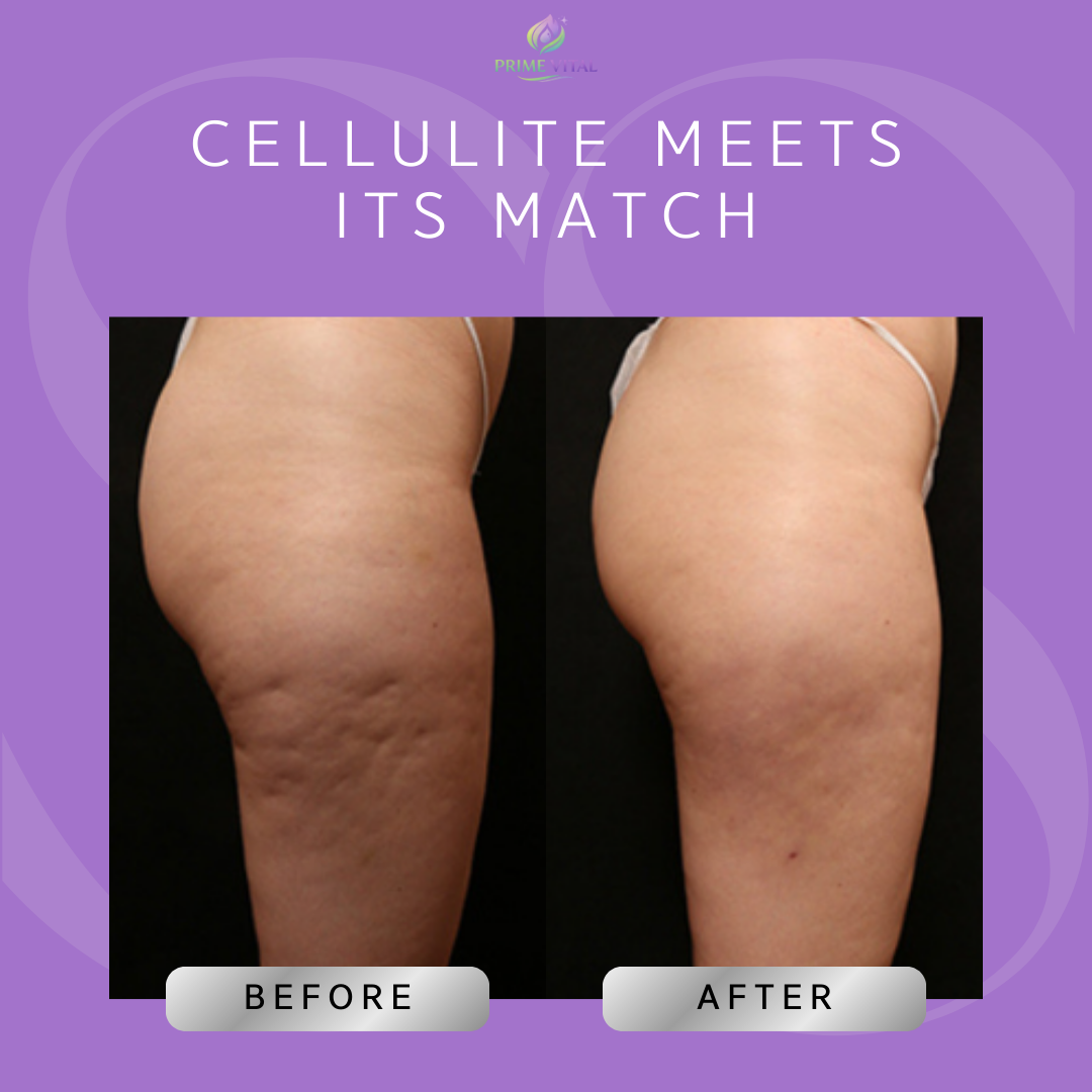 Prime Vital 3 in 1 Imperfection Cream