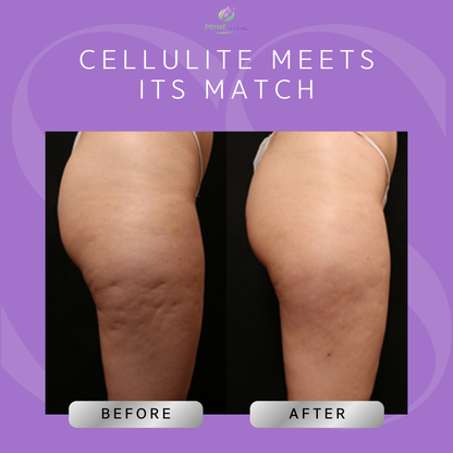 Prime Vital 3 in 1 Imperfection Cream